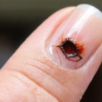 découvrez nos conseils essentiels pour favoriser la repousse optimale de l'ongle après une blessure de la matrice. techniques de soin et recommandations pour des ongles sains et résistants.